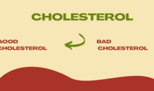 Cholesterol management